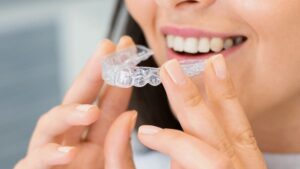 Invisalign in Langley: Why Clear Aligners Are Popular in 2026