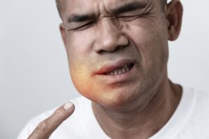 Why Rapid Facial Swelling Is a Medical Emergency?