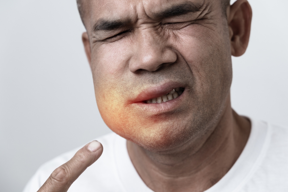 Emergency Dentist Langley